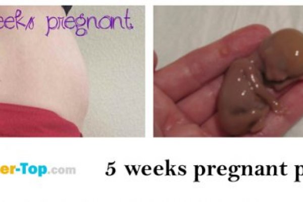 Кракен маркетплейс